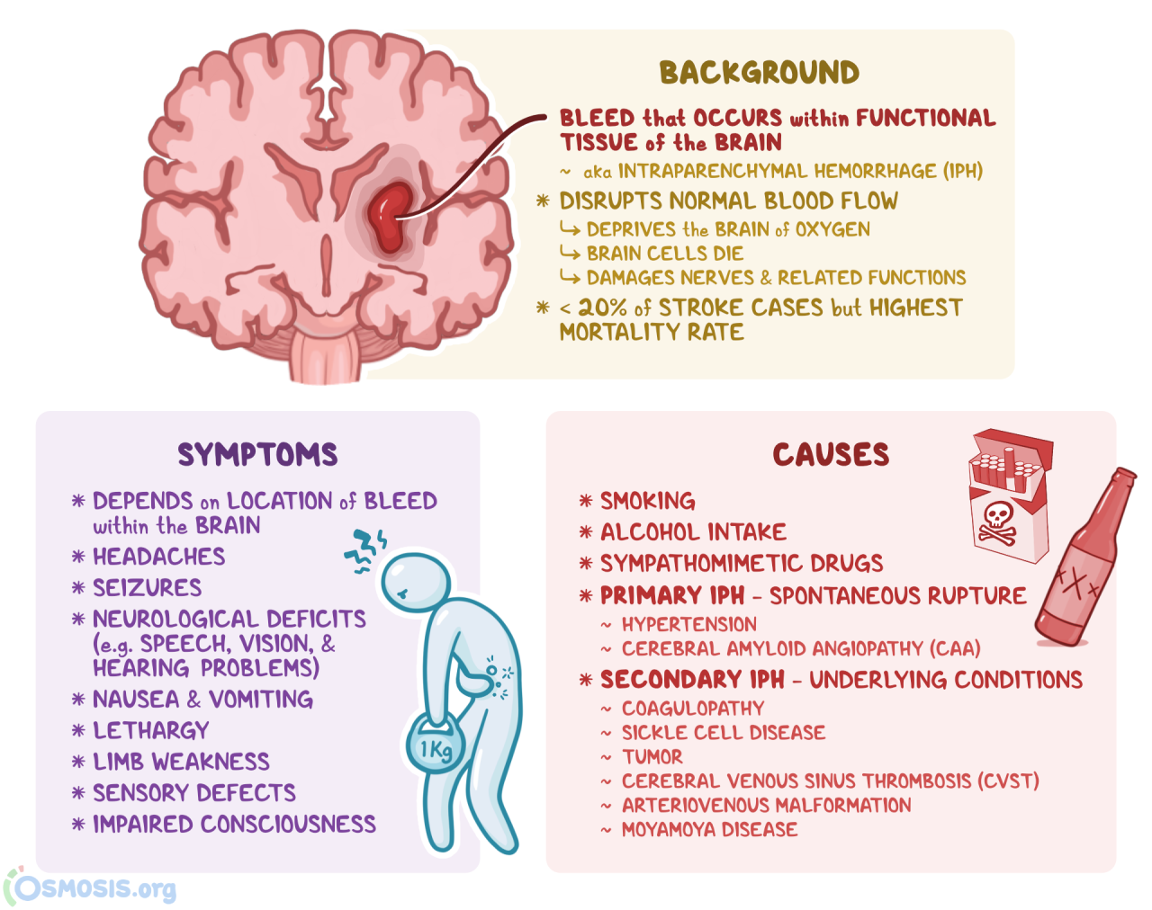 Parenchymal Hemorrhage: What Is It, Causes | Osmosis
